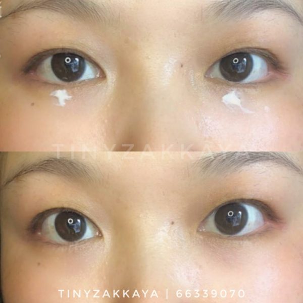 ATTENIR Eye Extra Serum 保濕緊緻全效眼霜 15g アテニア アイ エクストラ セラム 5