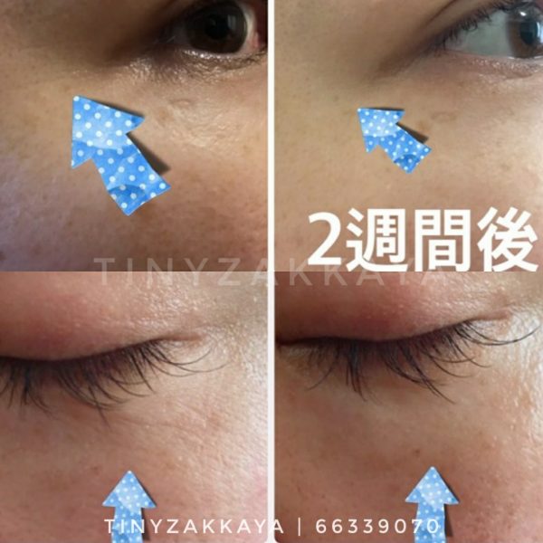 ATTENIR Eye Extra Serum 保濕緊緻全效眼霜 15g アテニア アイ エクストラ セラム 9